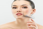 Loại bỏ những vết sẹo xấu xí thật đơn giản