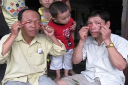 Dị nhân ăn ớt không thấy cay