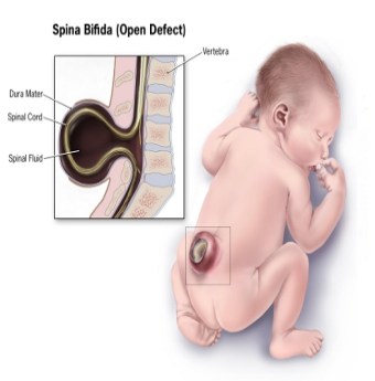Muốn con không dị tật, tránh xa những thực phẩm này khi mang bầu