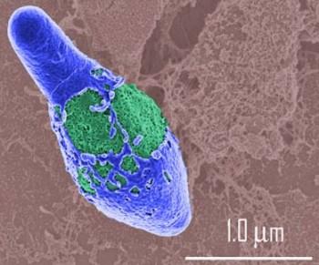 Sữa nhiễm vi khuẩn C.botulinum có đáng lo? 3